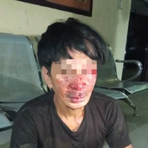 Diduga Maling Motor, Lelaki Ini Bonyok Dihajar Massa