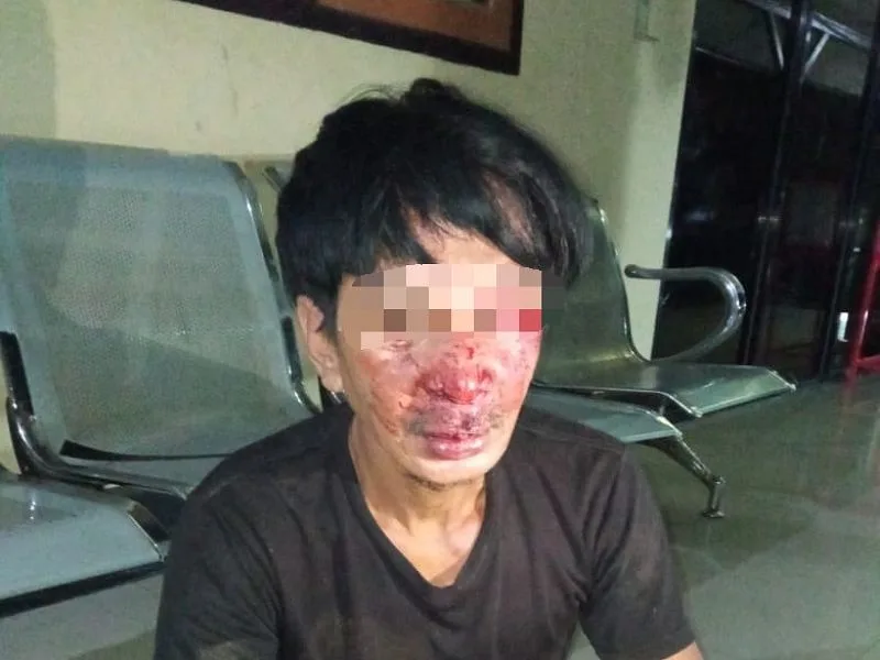 Diduga Maling Motor, Lelaki Ini Bonyok Dihajar Massa