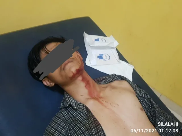 Cekcok Mulut Berakhir Penusukan Hingga Usus Keluar