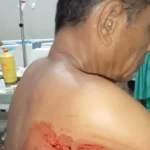 Keamanan Cafe Cassablanca Jadi Korban Penusukan