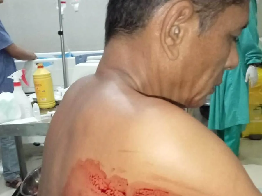 Keamanan Cafe Cassablanca Jadi Korban Penusukan