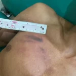 Lagi Santai Petani Mukomuko Dipukul Pakai Golok