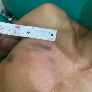 Lagi Santai Petani Mukomuko Dipukul Pakai Golok