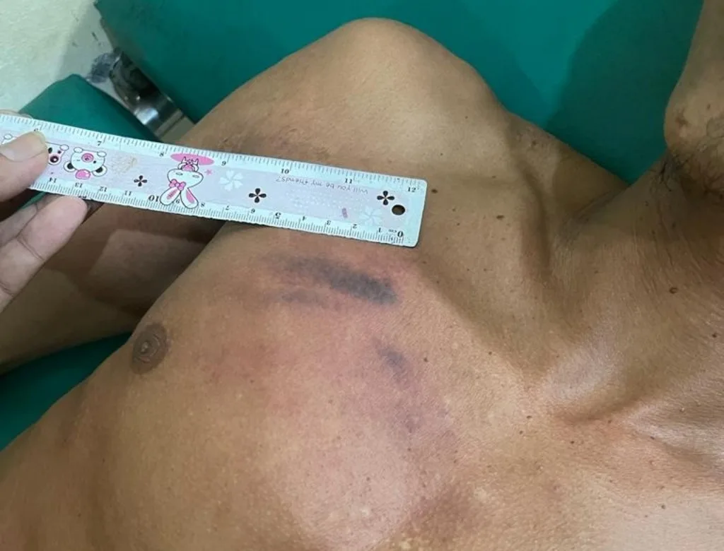 Lagi Santai Petani Mukomuko Dipukul Pakai Golok