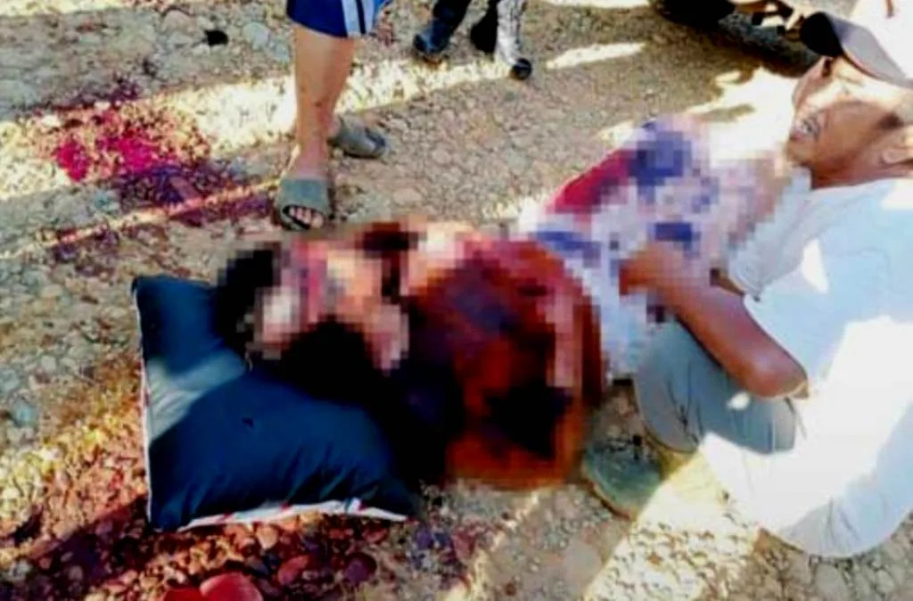 Suami Bacok Punggung Istri Berkali-kali Karena Cemburu