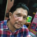 Ketua SMSI Madina Dianiaya, SMSI Pusat Desak Polisi Tuntaskan Kasus