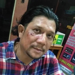 Ketua SMSI Madina Dianiaya, SMSI Pusat Desak Polisi Tuntaskan Kasus Ketua SMSI Madina Dianiaya, SMSI Pusat Desak Polisi Tuntaskan Kasus