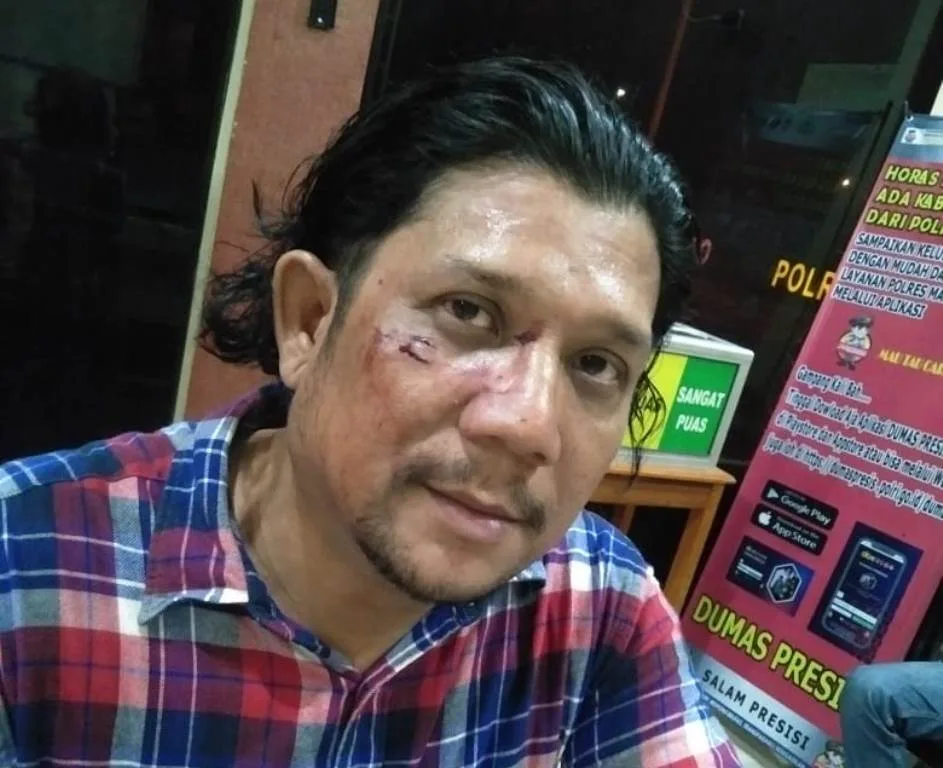 Ketua SMSI Madina Dianiaya, SMSI Pusat Desak Polisi Tuntaskan Kasus