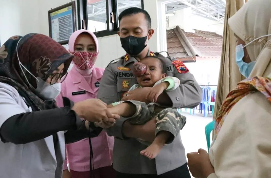 Mengharukan, Balita Penderita Tumor Mata Dijemput Kapolres Banjarnegara