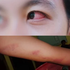 Aniaya Pelajar, Tiga Warga Lebong Dilaporkan ke Polisi Aniaya Pelajar, Tiga Warga Lebong Dilaporkan ke Polisi