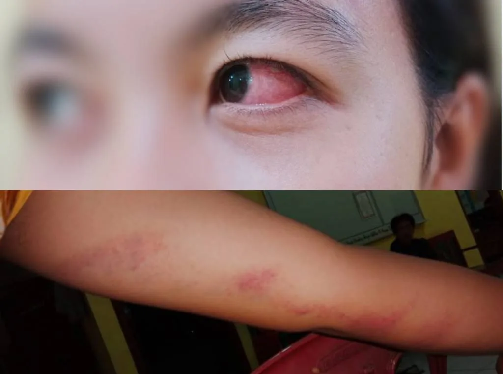 Aniaya Pelajar, Tiga Warga Lebong Dilaporkan ke Polisi