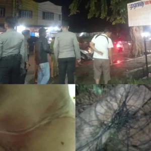 Terlilit Kabel Putus, Leher Pengendara Motor Luka Serius Di Karimun Terlilit Kabel Putus, Leher Pengendara Motor Luka Serius Di Karimun