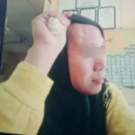 Murid Aniaya Guru Wanita Hingga Memar dan Benjol