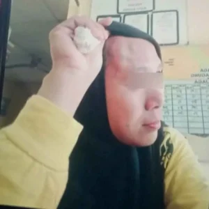 Murid Aniaya Guru Wanita Hingga Memar dan Benjol Murid Aniaya Guru Wanita Hingga Memar dan Benjol