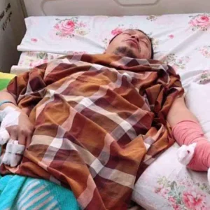 Operasi Berjalan Lancar, Wabup Kaur Kehilangan Sejumlah Jari