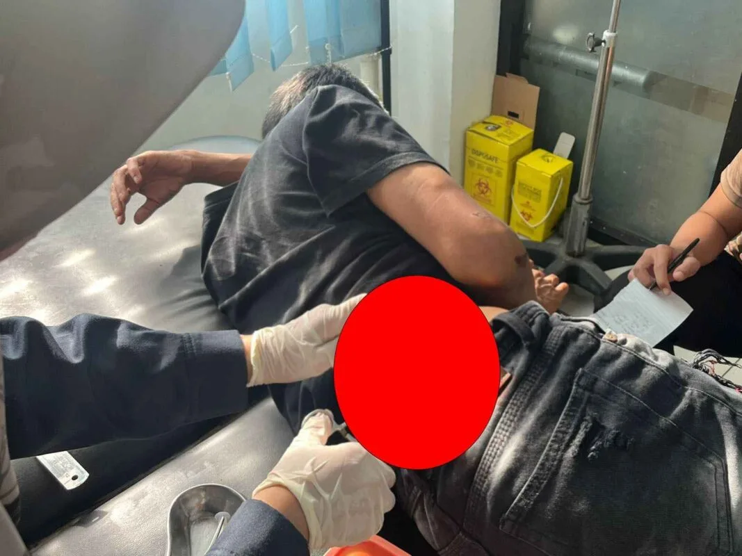 Diduga Ribut Masalah Perempuan, Pria Lebong Ditusuk