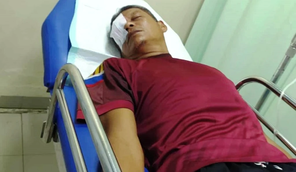 Tegur Siswa, Seorang Guru Alami Cacat Permanen