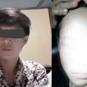 Diperiksa Polisi, Warga Kepahiang Malah Dapat Siksaan Hingga Gendang Telinga Pecah