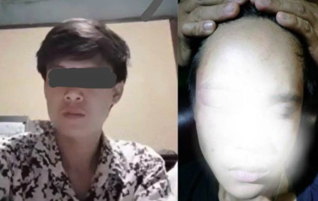 Diperiksa Polisi, Warga Kepahiang Malah Dapat Siksaan Hingga Gendang Telinga Pecah