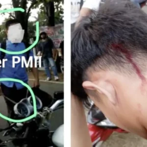 UINFAS Bengkulu Kisruh Sejumlah Mahasiswa Alami Luka-luka, Ada yang Bawa Sajam UINFAS Bengkulu Kisruh Sejumlah Mahasiswa Alami Luka-luka, Ada yang Bawa Sajam