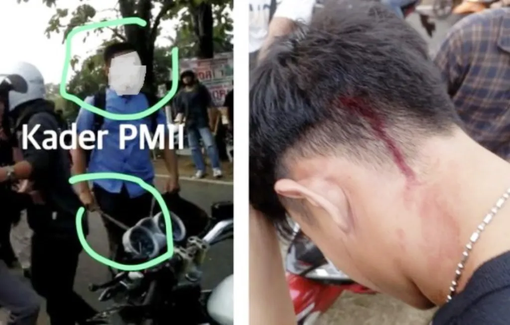 UINFAS Bengkulu Kisruh Sejumlah Mahasiswa Alami Luka-luka, Ada yang Bawa Sajam