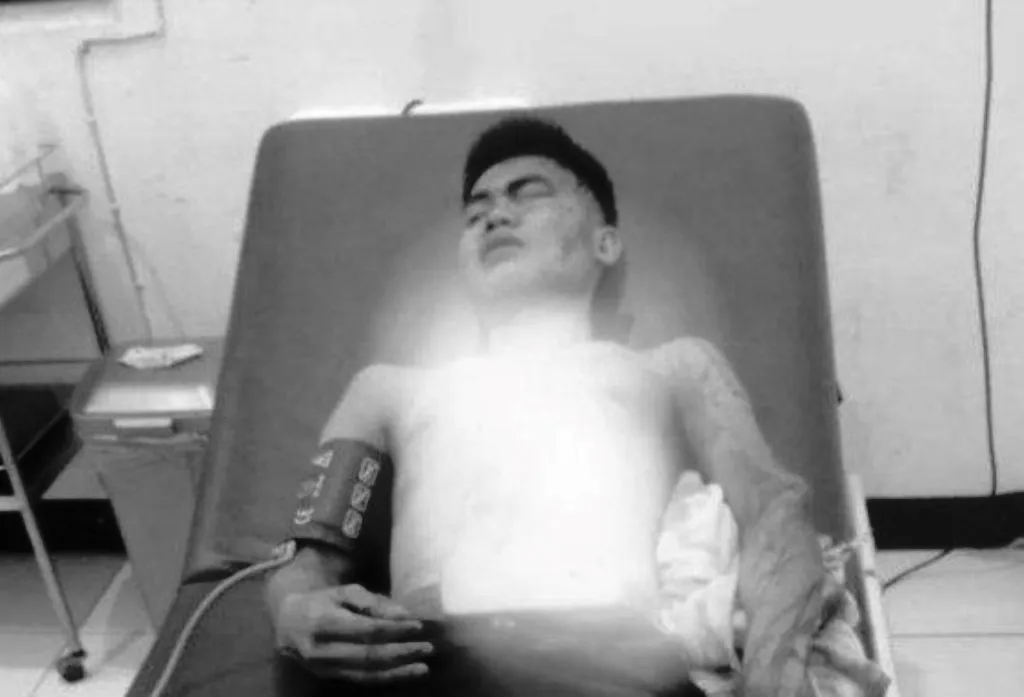 Sedang Duduk di Teras, Warga Bengkulu Selatan Ditebas Sajam