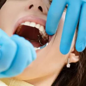 Cabut Gigi Bisa Batalkan Puasa? Ini Penjelasannya