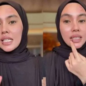 Disindir Kena Azab, Kartika Putri Buka Suara Soal Penyakitnya Disindir Kena Azab, Kartika Putri Buka Suara Soal PenyakitnyaÂ