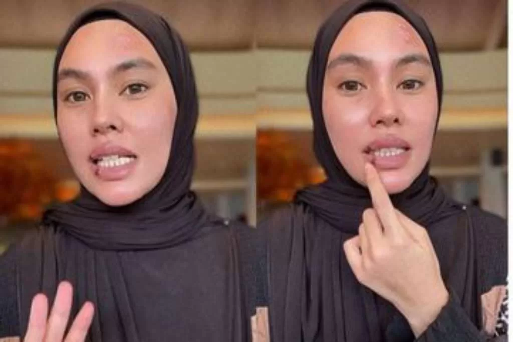 Disindir Kena Azab, Kartika Putri Buka Suara Soal PenyakitnyaÂ 