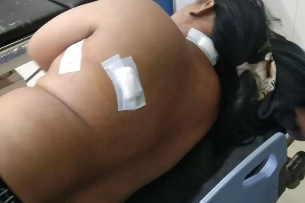 Guru Madrasah Aliyah di Tegal Dibacok Sekelompok Orang Gara-Gara Ini