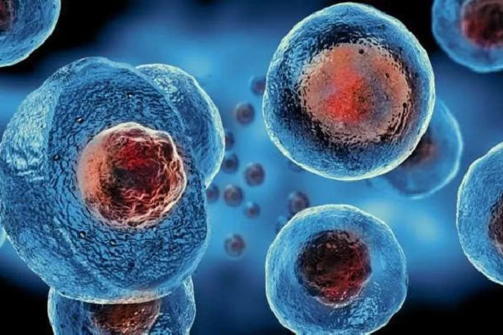 Jadi Harapan Baru dalam Mengatasi Kanker Darah, Apa Itu Stem Cell?