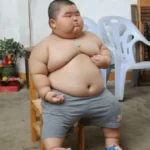 Obesitas pada Anak dan Remaja Tingkatkan Risiko Kekurangan Zat Besi