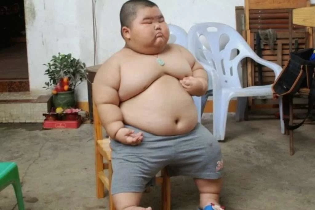 Obesitas pada Anak dan Remaja Tingkatkan Risiko Kekurangan Zat Besi