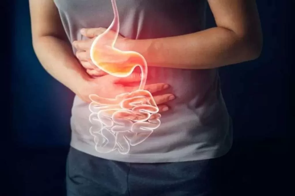 Perbedaan antara GERD dan Asam Lambung, Ini Gejala dan Pencegahan
