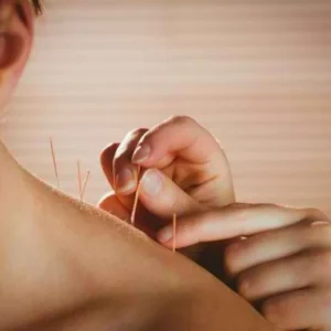 Bantu Kurangi Risiko Hipoglikemia pada Penderita Diabetes, Ini Manfaat Akupunktur Bantu Kurangi Risiko Hipoglikemia pada Penderita Diabetes, Ini Manfaat Akupunktur