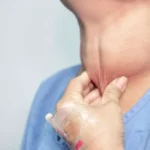 Dokter Spesialis RSUPN Cipto Ungkap Pentingnya Deteksi Dini Kelainan Tiroid