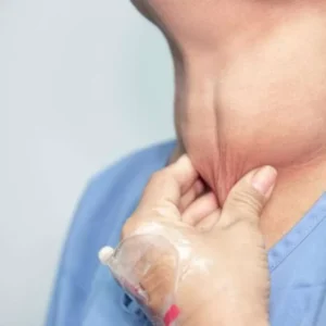Dokter Spesialis RSUPN Cipto Ungkap Pentingnya Deteksi Dini Kelainan Tiroid