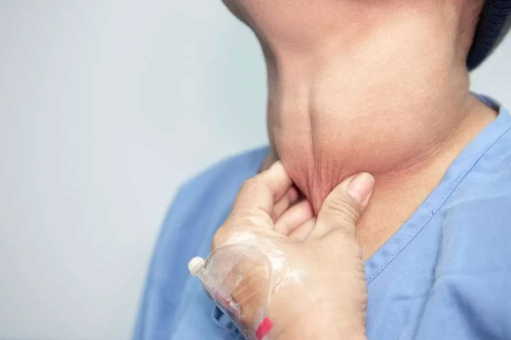 Dokter Spesialis RSUPN Cipto Ungkap Pentingnya Deteksi Dini Kelainan Tiroid