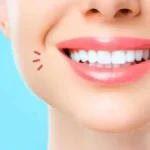 Tips Perawatan Alami dan Aman untuk Memutihkan Gigi di Rumah