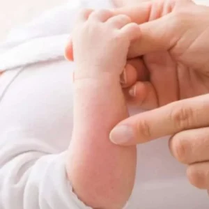 Dokter Spesialis: Asap Rokok Merusak Kulit Anak dan Pori-porinya