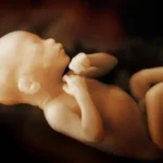 Penemuan Baru, Studi Ungkap Perbedaan Pertumbuhan Otak pada Anak dengan Autisme