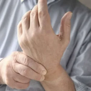 Tips Penting untuk Meningkatkan Kualitas Hidup Bagi Penderita Lupus
