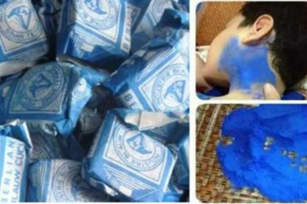 Blau Efektif untuk Obati Gondongan? Fakta atau Mitos?