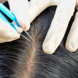 Fakta Tentang Mencabut Uban dan Dampaknya pada Rambut