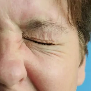 Perbedaan Stroke dan Bell’s Palsy, Gejala dan Penyebab yang Perlu Diketahui Perbedaan Stroke dan Bell’s Palsy, Gejala dan Penyebab yang Perlu Diketahui
