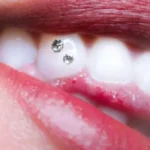 Tips Memutihkan Gigi Kuning Secara Alami Mudah dan Hemat