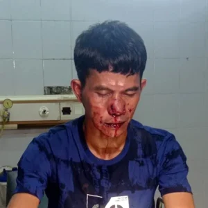 Jurnalis Dikeroyok 8 Orang Preman di Subang Jawa Barat