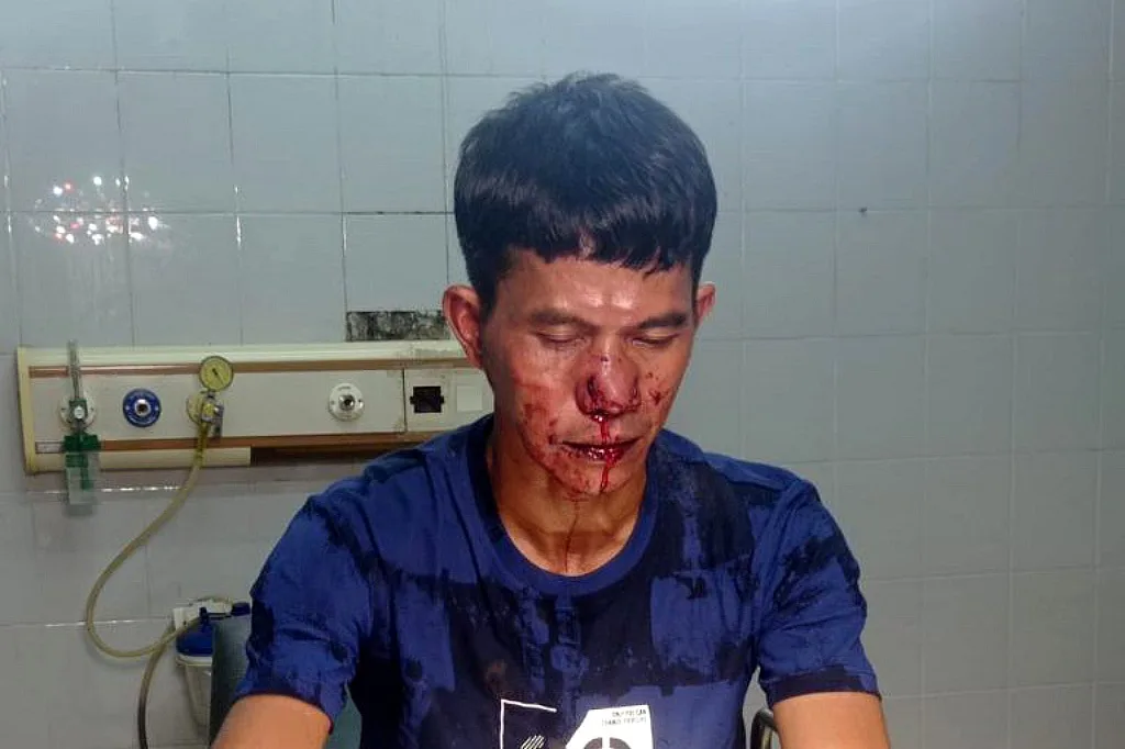 Jurnalis Dikeroyok 8 Orang Preman di Subang Jawa Barat