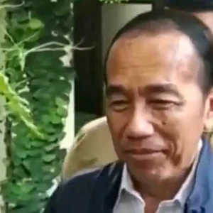 Kondisi Kulit dan Rambut Jokowi Jadi Sorotan Warganet: Gejala Autoimun atau Hiperkortisolisme?
