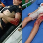 Tiga Bocah Terluka Parah, Terselamatkan Berkat Adanya Jadwal Kapal Penyeberangan